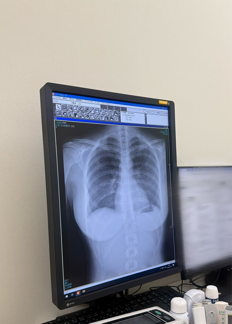 โทโยชิมะ โคโคโระ