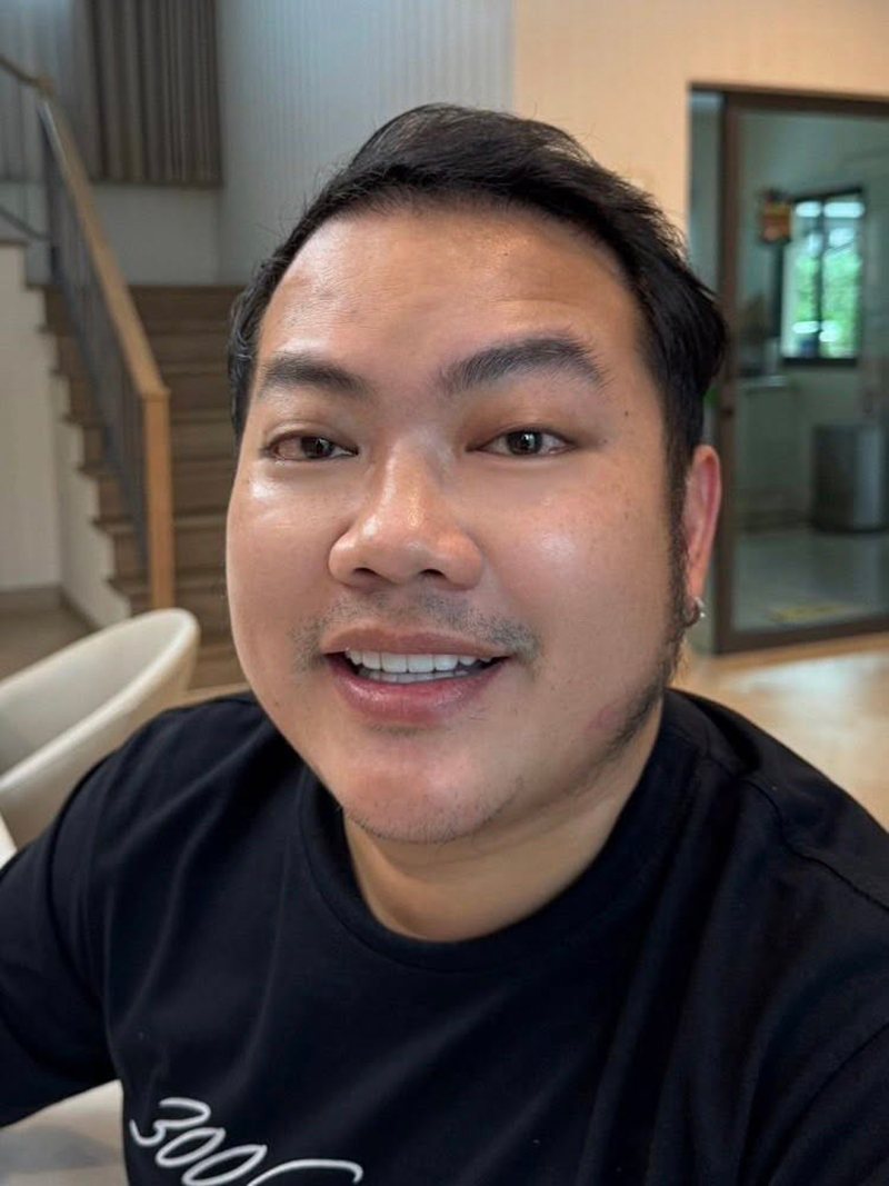 เบนซ์ อาปาเช่