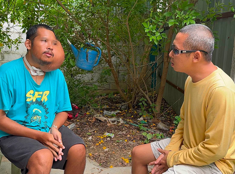 หนุ่มป่วยใบหน้าบวมครึ่งซีก