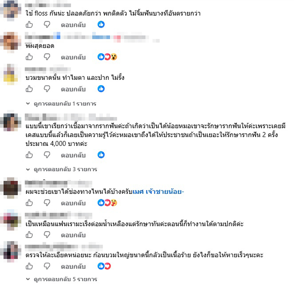 หนุ่มป่วยใบหน้าบวมครึ่งซีก