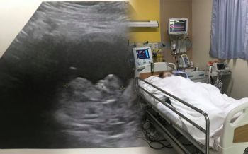 สุดเศร้า! หนุ่มเล่าประสบการณ์เมียท้องลูกแฝด  แต่สุดท้ายไม่รอดทั้งแม่-ลูก พร้อมตั้งคำถามรพ.ดัง