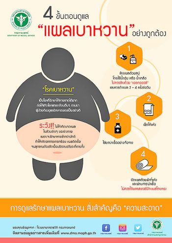 Life&Health : การดูแลเบาหวานแบบง่ายๆ