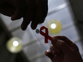 Health  News : พบแอนติบอดีที่อาจใช้ป้องกันและรักษาเอชไอวี