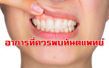 แพทย์แนะอาการของฟันที่ควรไปพบทันตแพทย์