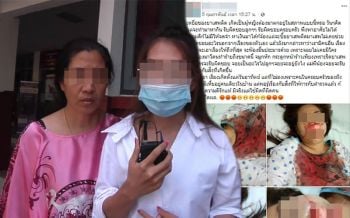 สาวโพสต์เฟสแฉ! โดนสามีทาสยาทำร้ายเจ็บปางตาย แม่ยายลั่นจะดำเนินคดีให้ถึงที่สุด