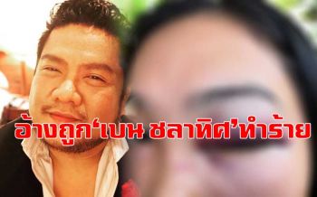 สาวโร่แจ้งความ! อ้างโดน\'เบน ชลาทิศ\' ตบหน้า-ต่อยตาบวมช้ำ