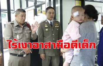 ไร้เงาอาสาสมัครมือฟาดกระบองถูกเด็ก 2 ขวบสลบ พ่อฉุน ตร.ไม่เรียกมาสอบสวน
