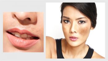5 ปัจจัยกระตุ้นที่ทำให้คุณกลับมาเป็นฝ้าอีก
