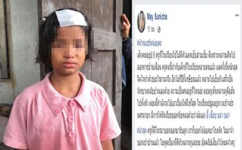 โวย!ลงโทษโหดป.6ลอกการบ้าน ครูไม้ฟาดหัวแตกเย็บ3เข็ม อ้างเด็กล้มเอง