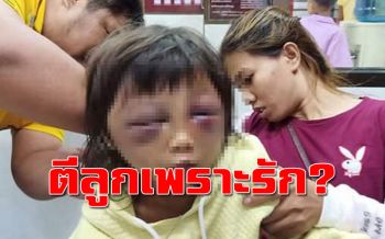 เด็ก5ขวบถูก ‘แม่แท้ๆ-พ่อเลี้ยง’ ทุบตีใบหน้าฟกช้ำเจ็บสาหัส