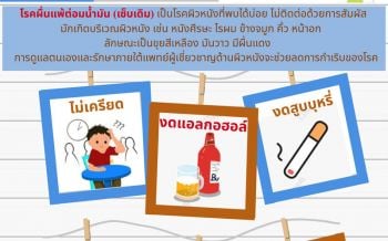 รู้ทัน ‘ผื่นแพ้ต่อมน้ำมัน’ โรคที่สร้างความรำคาญใจ