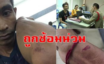 หนุ่มโวย!ถูกชายอ้างตัวเป็นตร. ขอตรวจฉี่-ถูกซ้อมน่วม ซ้ำไม่เจอให้เงิน100ซื้อยากินเอง