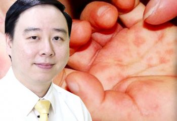 โรคมือเท้าปาก โรคระบาดในเด็กที่ต้องระวัง