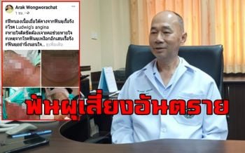 หมอเมืองคอนโพสต์เตือน \'คนฟันผุ\' ระวังอย่านิ่งนอนใจอันตรายถึงชีวิต