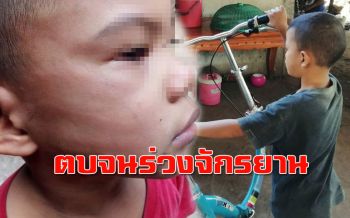 ตบจนร่วง! หนุ่ม อบต. ตบหน้าเด็ก 6 ขวบ เหตุทำรถบังคับลูกสาวพัง