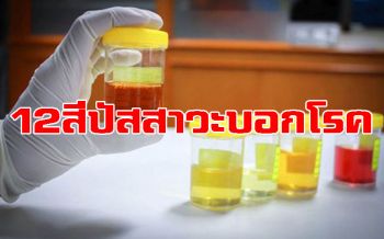 สีของปัสสาวะ...สัญญาณเตือนของปัญหาสุขภาพ