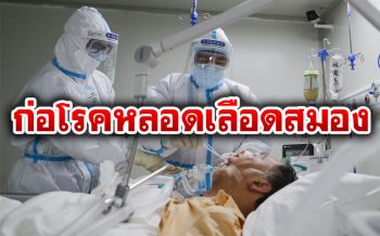 วิจัยพบอีก \'โควิด-19\'โจมตีระบบเลือด ก่อให้เกิดโรคหลอดเลือดสมอง