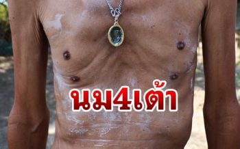 แปลกแต่จริง! ชาวอ่างทองวัย 63 ปี มีนม 4 เต้า ถูกล้อเป็นควายตั้งแต่เด็ก