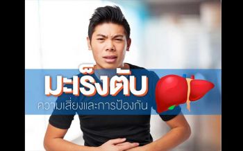 รู้ทัน‘มะเร็งตับ’…ความเสี่ยงและการป้องกัน โรคร้ายพบมากสุดในผู้ชาย