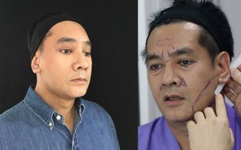 หน้าพังลุงยังเรียกพ่อ\'ต้น จักรกฤษณ์\'แอบไปขึ้นเขียงผ่าแหลก 5 จุด