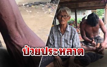 อึ้ง! ย่าหลานป่วยประหลาดเป็นตุ่มปวดทรมาน อ้างมีแมลงโผล่ออกมาจากผิวหนัง