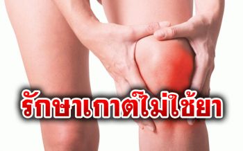 แพทย์แนะโรคเกาต์รักษาด้วยวิธีง่ายๆ โดยไม่ต้องพึ่งยา
