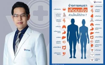 มะเร็งร้าย เป็นได้ทุกส่วนของร่างกาย