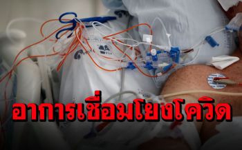 อังกฤษวิจัยพบ‘กลุ่มอาการใหม่’4อย่าง เชื่อมโยงป่วยโควิด-19