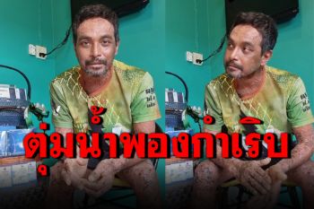 \'เมฆ วินัย\'กับภาพล่าสุดหลังป่วยตุ่มน้ำพอง เผยวงการบันเทิงคงไม่มีใครจ้าง