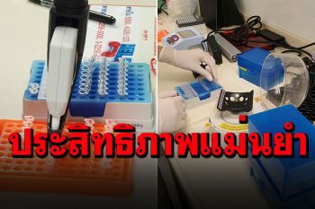 แพทย์จุฬาฯพัฒนานวัตกรรม COVID-19 SCAN ชุดตรวจเชิงรุก รวดเร็ว-แม่นยำ-ย่อมเยา