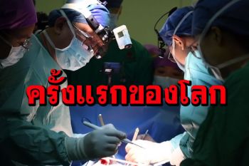 ครั้งแรกของโลก! จีนผ่าตัดปลูกถ่ายหัวใจ แบบ‘ไม่มีภาวะขาดเลือด’สำเร็จ (ชมคลิป)