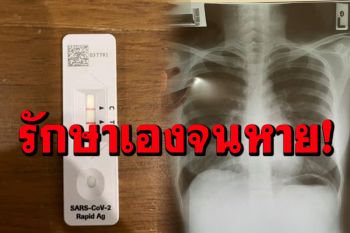 \'เภสัชกร\'ติดโควิด! รีวิวการ Home Isolation รักษาตัวเองที่บ้าน จนหายใน 9 วัน