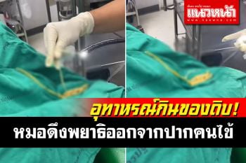 สุดสะพรึง! หมอดึงพยาธิยาวหลายเมตร ออกจากปากคนไข้ เหตุกินอาหารสุก ๆ ดิบ ๆ