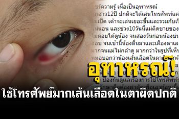 อุทาหรณ์! ลูกเล่นโทรศัพท์มือถือ-เรียนออนไลน์ เกิน 8 ชม.จนเลือดไหลออกจากตา