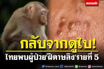 ไทยพบผู้ป่วยฝีดาษลิงคนที่ 5 เป็นหญิงไทยวัย 25 พบเดินทางกลับจากดูไบ