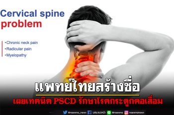 แพทย์ไทยสร้างชื่อเผยเทคนิค PSCD รักษาโรคกระดูกคอเสื่อมสู่สายตาต่างชาติ