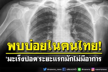 \'มะเร็งปอด\'พบบ่อยในคนไทย แพทย์เผยระยะแรกไม่พบอาการ ชี้ปัจจัยเสี่ยงก่อให้เกิดโรค