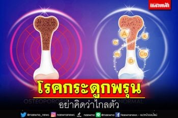 โรคกระดูกพรุน อย่าคิดว่าไกลตัว