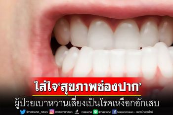 \'ทันตแพทย์\'ชี้ผู้ป่วยเบาหวาน เสี่ยงโรคเหงือกอักเสบ ไม่ควรมองข้ามสุขภาพช่องปาก
