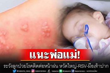 แนะพ่อแม่! ระวัง\'ลูก\'ป่วยโรคติดต่อหน้าฝน หวัดใหญ่-RSV-มือเท้าปาก