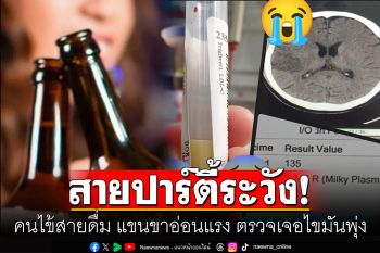 สายปาร์ตี้ต้องระวัง! คนไข้สายดื่ม แขนขาอ่อนแรง ตรวจเจอไขมันพุ่ง แยกเป็นชั้นคล้ายน้ำมันหมู