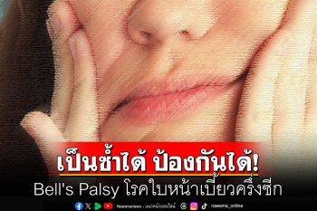 Bell\'s Palsy โรคใบหน้าเบี้ยวครึ่งซีก หายได้ เป็นซ้ำได้ ป้องกันได้!