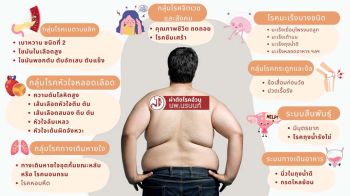 การรักษาโรคอ้วนด้วยการผ่าตัดกระเพาะ  อีกหนึ่งวิธีในการต่อสู้กับภาวะโรคอ้วนรุนแรง