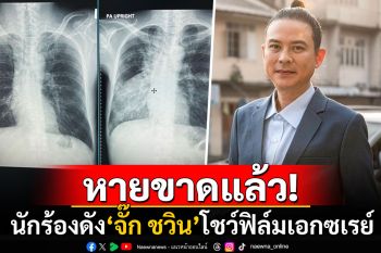 ยินดีเพียบ! \'จั๊ก ชวิน\'เผยภาพฟิล์มเอกซเรย์ปอด ประกาศหายขาดจาก\'วัณโรค\'แล้ว