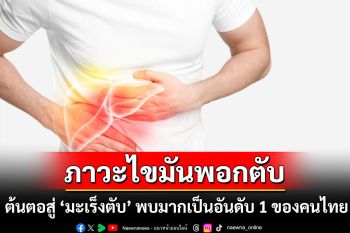 ภาวะไขมันพอกตับ ต้นตอสู่ ‘มะเร็งตับ’ พบมากเป็นอันดับ 1 ของคนไทย