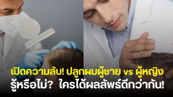 การปลูกผมในผู้ชายและผู้หญิงแตกต่างกันอย่างไร