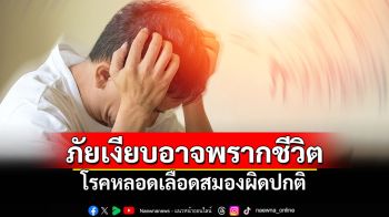 โรคหลอดเลือดสมองผิดปกติ ภัยเงียบที่อาจพรากชีวิต