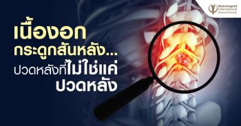 ระวัง !! ปวดหลัง แค่ไม่ใช่ปวดหลัง อาจเสี่ยงเนื้องอกกระดูกสันหลัง