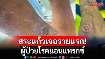 ด่วน! สระแก้วเจอรายแรก ผู้ป่วยโรคแอนแทรกซ์ เผยพฤติกรรมเสี่ยง ดื่มสุรา กินซอยจุ๊
