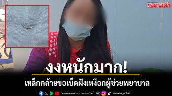 อุทาหรณ์กินขนมจีน! ผู้ช่วยพยาบาลเจ็บคอ หมอผ่าตัดพบเหล็กปริศนา 3 ซม.ฝังเหงือก